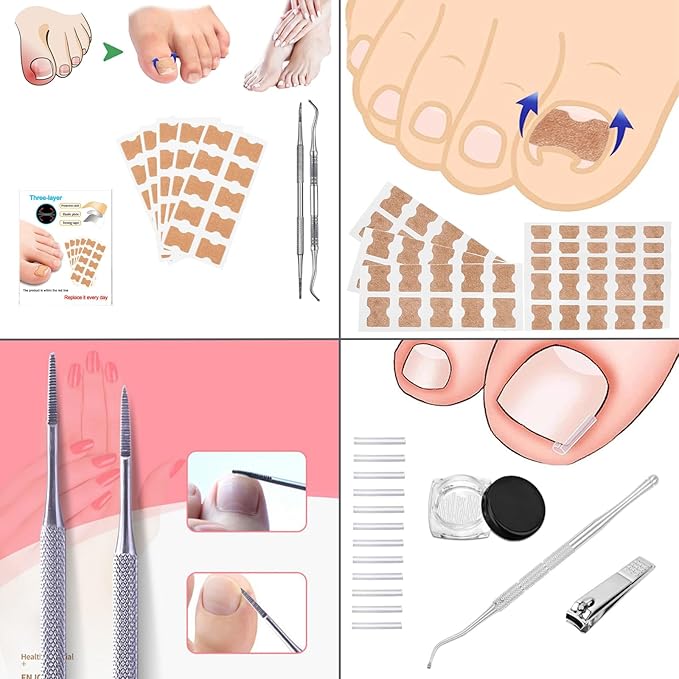 Ingrown Toenail Corrector Kit, 16PC Professional Ingrown Toenail Removal Kit with Correction Strips, Painless Treatment for Ingrown Toenail Pain Relief for Home Pedicure Care