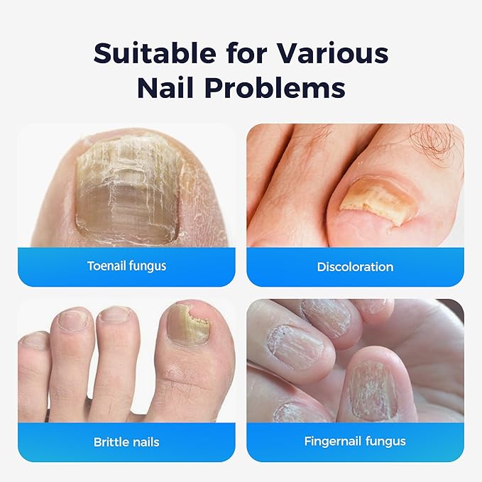 Fungal Nail Patches & Nail Repair Pen,Fast-Acting 7 Days Toenail Treatment Extra Strength With Tea Tree Oil, Acetic Acid Nail Pens for Damaged Nail