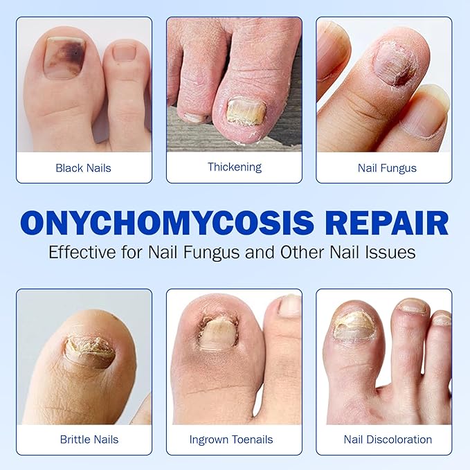 Nail Treatment Patches, 21 Pcs Discolored Thickened Nails Repair, 8 Hour Nightime Nail Renewal Waterproof for men women