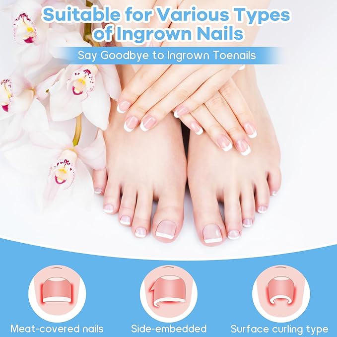 Ingrown Toenail Removal Kit with Ingrown Toenail Strips, Curved Toenails Corrector Patch, Nail File and Lifter Pedicure Tools for Women Man