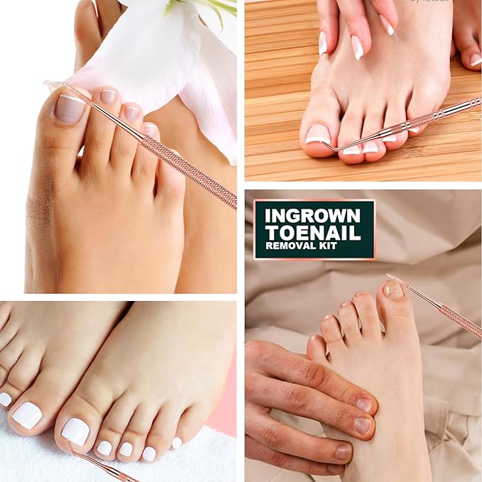 Teenitor Pedicure Tools for Feet, Toenail File and Lifters, Ingrown Toenail Removal Kit Pain Relief (Rose Gold)