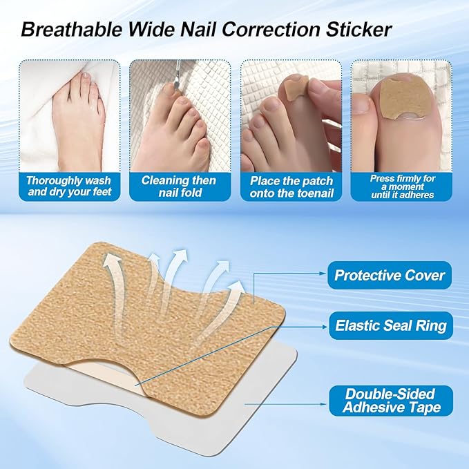 Ingrown Toenail Corrector Set with Correction Strips, Professional Ingrown Toenail Removal Kit, Painless File and Lifter Pedicure Tool Curved Toenails Corrector Patch for men and women