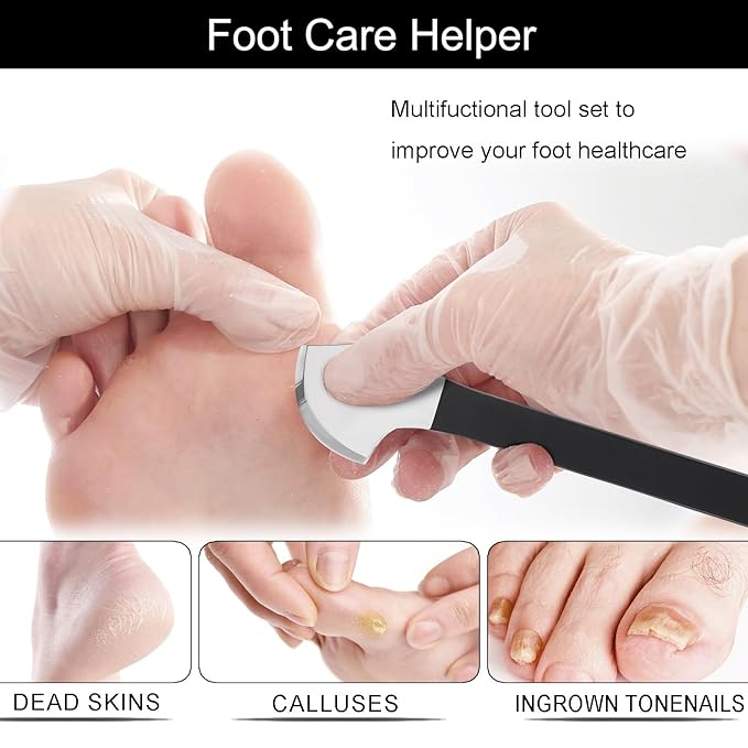 Segbeauty 7pcs Ingrown Toenail Removal Kit, Professional Pedicure Tools for Feet, Callus Shaver Cuticle Remover Kit with Storage Bag, Foot Corn Remover Home Pedicure Knife with Knife Sharpener Stone