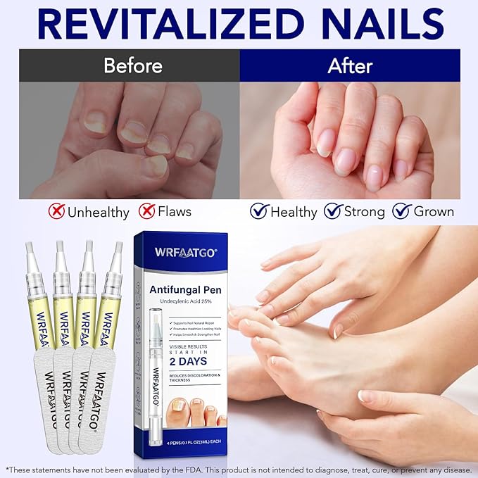 Toenail Treatment Extra Strength, Nail Repair Pen, Nail Treatment for Damaged, Discolored & Thickened Nails, Nail Repair, Restore Healthy Nail Appearance