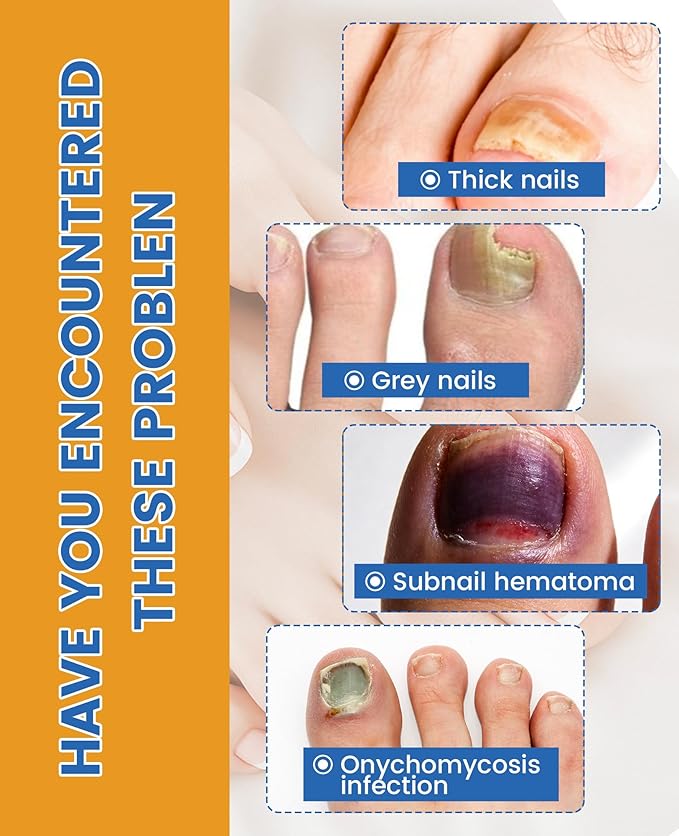 Nail TreatmentFungal Nail Patches For Toenails 32patches, Restore The Nails’ Natural Strength And Clarity.