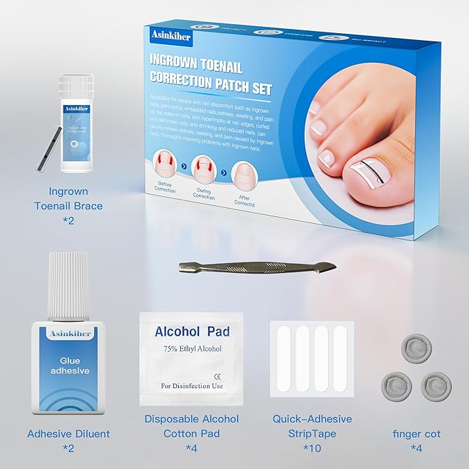 Titanium Alloy Ingrown Toenail Treatment, Ingrown Toenail Removal Kit for Curved Nail Repair, Ingrown Nail Tool for Home Use