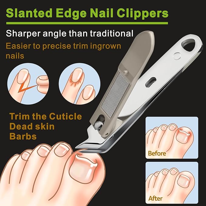 Slanted Pointed Ingrown Nail Clippers,Slanted Edge Blades for Thick Fingernails and Toenails,Angled Toenail Clippers with Non Slip Handle,Cuticle Trimmer,Built in File,Stainless Steel,Extremely Sharp