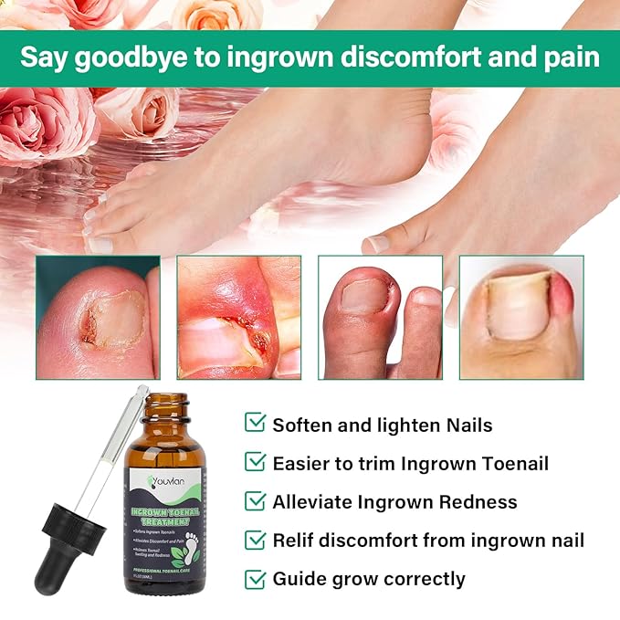 Ingrown Toenail Treatment - Ingrown Toenail Softener Drops,Toenail Lifter,Nail Patches,Best Ingrown Toenail Kit at Home for Easy Trim Thick Toe Nails Cleaner Tool Kit
