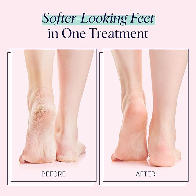 SpaLife Moisturizing Foot Sockies | Foot Mask for Dry Cracked Feet Intensive Repair Treatment | Tea Tree Oil Softening Booties | Callus Remover Alternative | Self Care Gifts for Women | 8 Pack