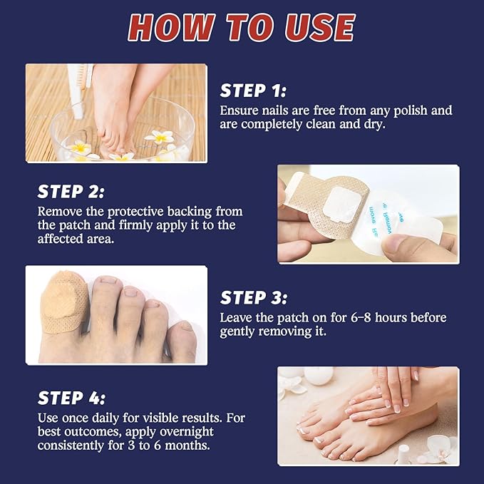 30 Pcs Extra Strength Nail Repair Patches - Overnight Renewal for Damaged, Discolored & Thickened Toenails & Fingernails for Men and Women