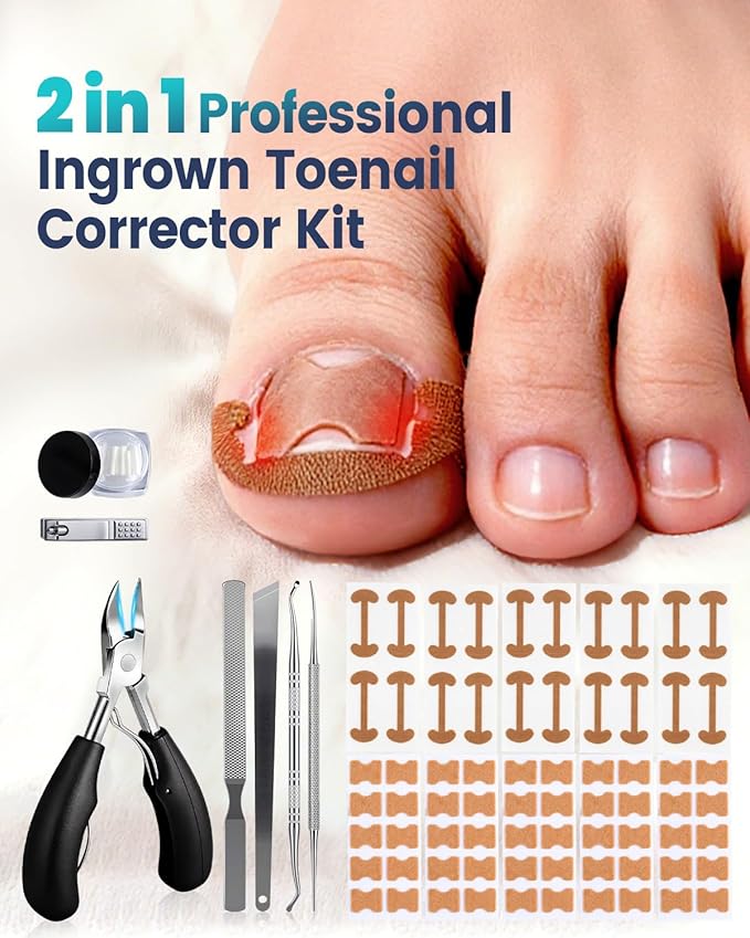 Professional Ingrown Toenail Corrector, 2-in-1 Ingrown Toenail Removal Kit with U-Shaped Strips and Correction Patch, Ingrown Toenail Clippers Tool Set- Effective Removal of Ingrown Toenails (Gold)