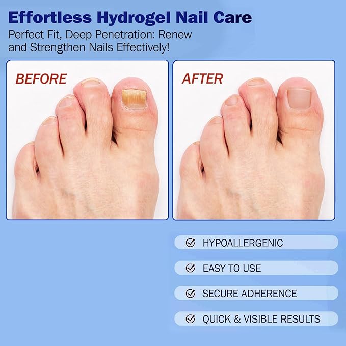 Fungal Nail Patches for Toenails, 21 Count - Nail Repair Patches with 8-Hour Adhesion, for Discolored & Damaged Toenails Care, Overnight Renewal for Men & Women