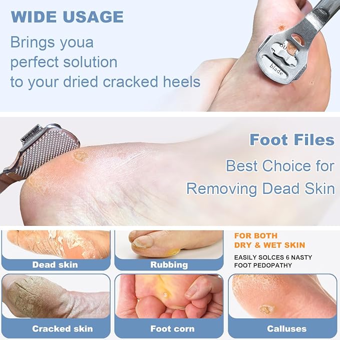 37 Pcs Callus Shaver for Feet Set, Foot Callus Shaver, (1 Foot Razor for Callus Removal &1 File Heads & 4 Pedicure Knife & 1 Nail Clippers & 30 Replacement Slices Blades)