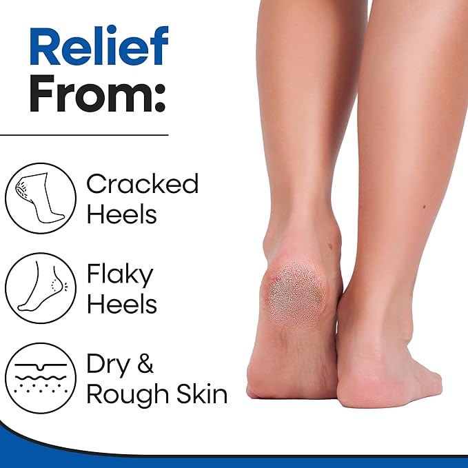 Moisturizing Socks for Mens Cracked Heels - Moisturizer Heel Sleeves to Smooth & Soften Rough Cracked Heels & Dry Feet. Large Aloe Moisturizing Heel Socks (White - 3 Pairs, Fits Most)