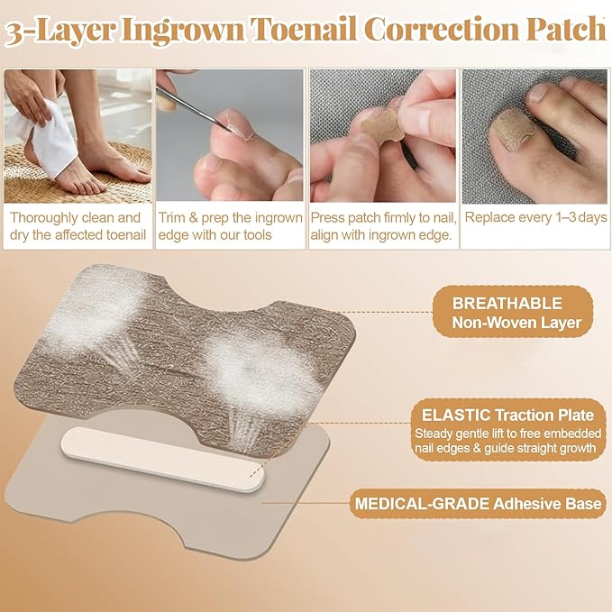 Ingrown Toenail Removal & Corrector Kit for Fast Pain Relief - Professional Ingrown Toenail Treatment Kit with Curved Strips, Breathable Patches & Pedicure Tools, Prevention & Healthy Nail Growth