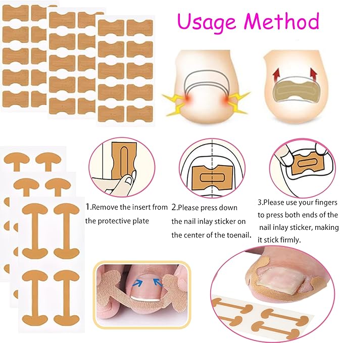 Ingrown Toenail Corrector Kit with Flexible Correction Strips & Tape – Professional Home Pedicure Tool Set for Painless Ingrown Nail Treatment, Toenail Brace & At-Home Care
