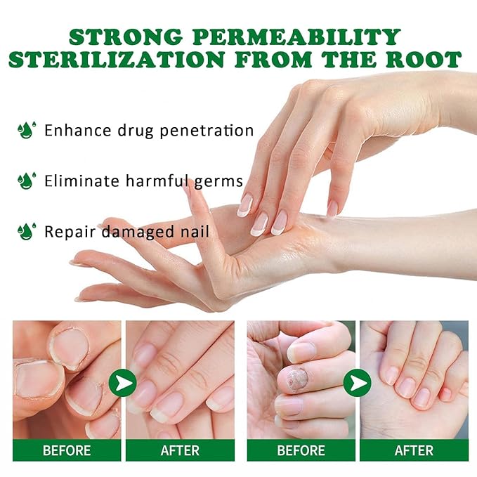 Nail Treatment Gel, Nail Growth Serum for Repair & Strengthener (1)