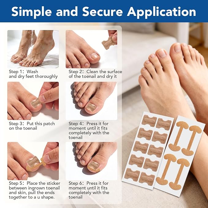 120pcs Ingrown Toenail Removal Kit, Professional Ingrown Toenail Corrector Kit, 3 Types Shaped Strips Toenail Stickers with 5 Pedicure Tools, Effective Removal of Ingrown Toenails