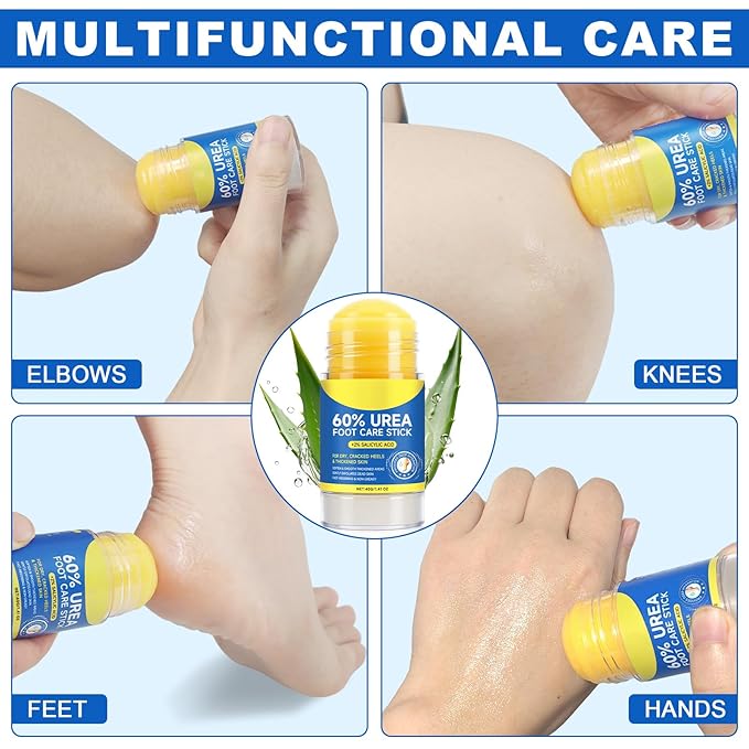 60% Urea Foot Cream Stick with 2% Salicylic Acid, Urea Foot Care Stick & Cream - Moisturizer for Dry, Cracked Skin on Feet, Knees, Elbows & Hands - Hydrates & Repairs Rough Skin 1Pack