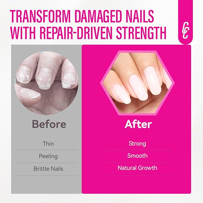 Protein Nail Strengthener for Gel Enthusiasts: Repair Thin Weak Peeling Nails After Acrylics Gel Removal - Milky White Nail Hardener and Growth Treatment Ridge Filler Milky White Polish
