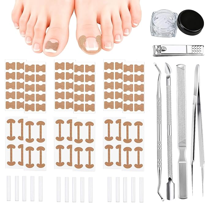Ingrown Toenail Corrector Set with Correction Strips, Professional Ingrown Toenail Removal Kit, Painless File and Lifter Pedicure Tool Curved Toenails Corrector Patch for men and women