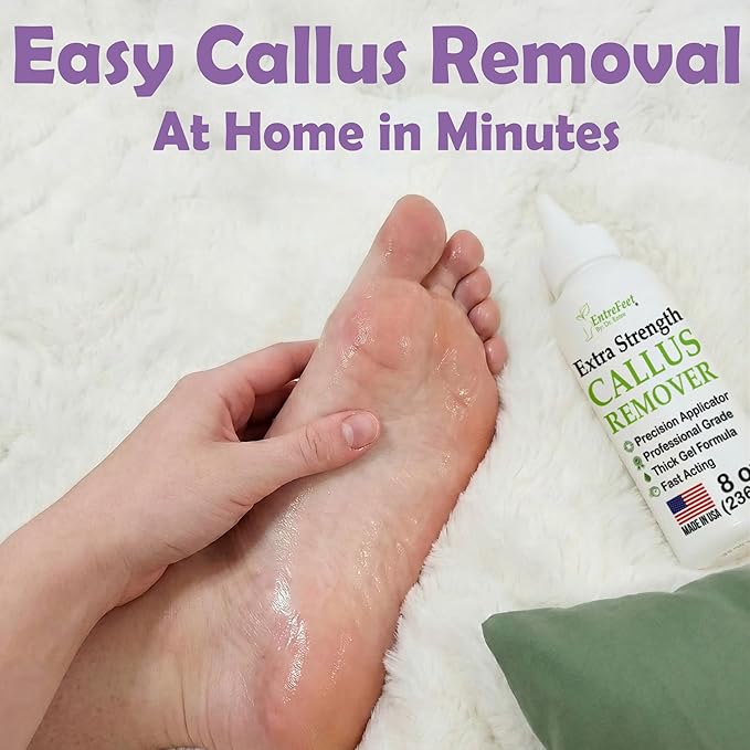 Callus Remover for Feet (Extra Strength 8 oz) Foot Callus Remover Gel, Spa Foot Care, Pedicure Tools for Feet Scrubber