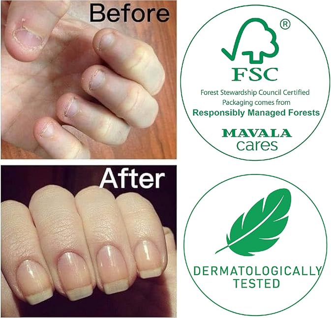 Mavala Stop Deterrent Nail Polish Treatment | Nail Care to Help Stop Putting Fingers In Your Mouth | Bitter Taste | Easy Application | For Ages 3+ | 0.3 Fl Oz