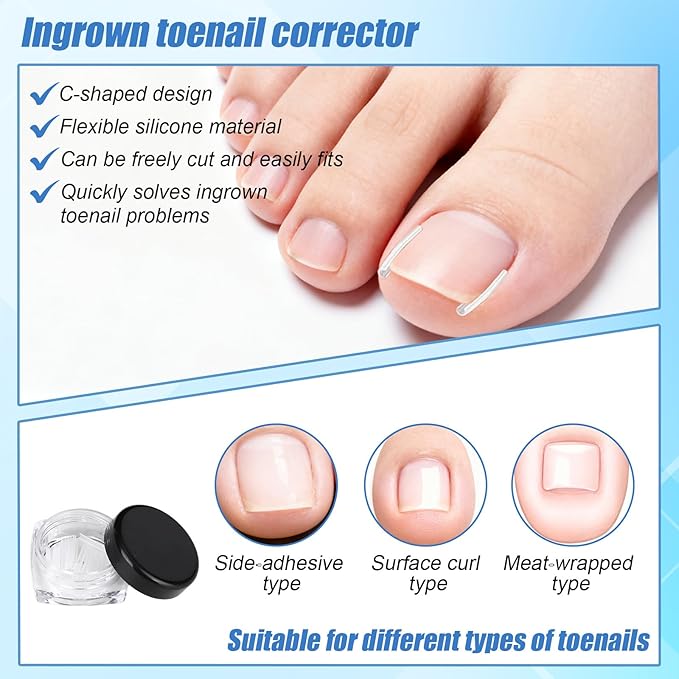 Professional Ingrown Toenail Removal Kit, Including Ingrown Toenail C-Shaped Patch Tools, Wide Nail Corrector Sticker, Correction Sticker Strips & Toe Separator, etc for Home Pedicure