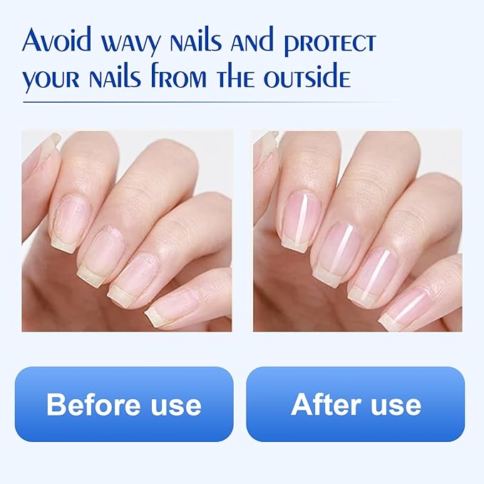 Natural Nail Hardener, Fast Absorbing Hyaluronic acid Nail Care Solution for Cracked Cuticles&Dry Nails, Improve Nail Gloss Moisturizes Conditions and Strengthens Resilient Cuticle Oil-2 Pcs