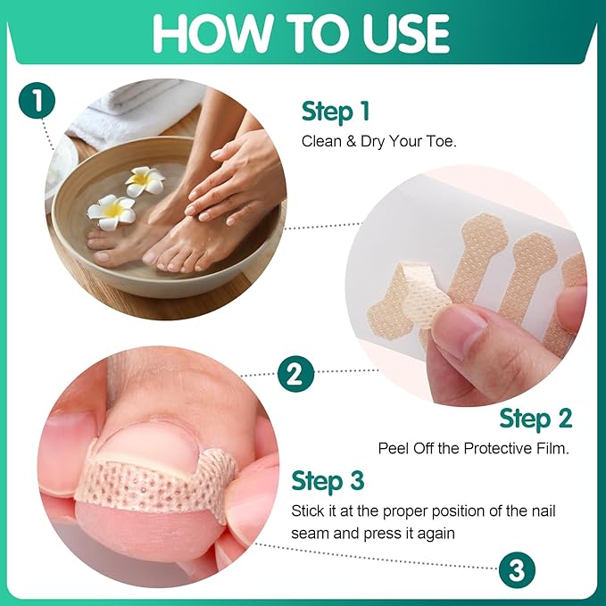 Ingrown Toenail Treatment, 60 Pcs Breathable Ingrown Toenail Strips, Painless Toenail Support Tool for At-Home Pedicure and Foot Care, Toenail Corrector Patch （60 Count (Pack of 1)）
