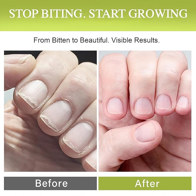 Nail Biting Treatment for Kids, Nail Biting Prevention, No Bite Cream for Gentle Care & Stop Thumb Sucking, Safe and Natural Plant Bitter Formula