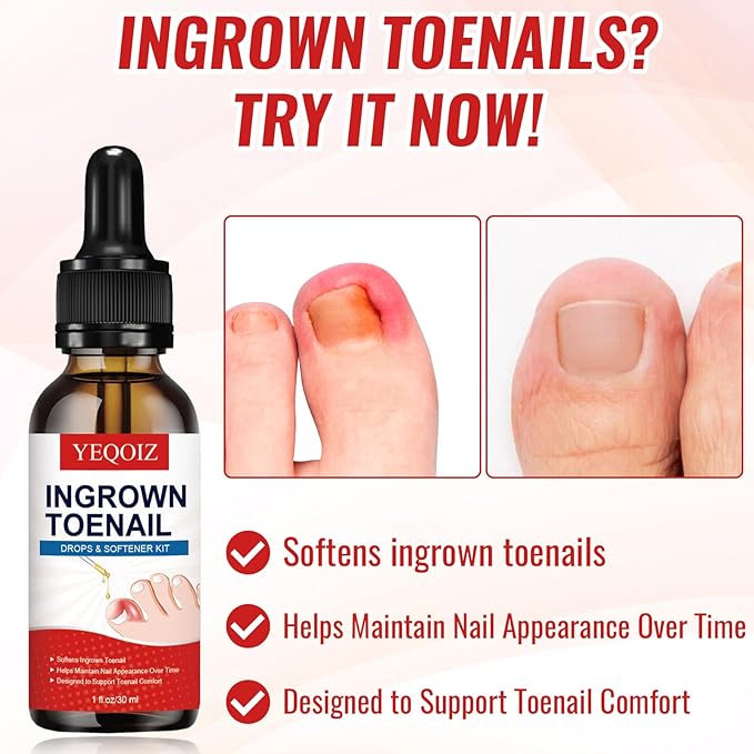 Ingrown Toenail Removal Kit, Ingrown Toenail Tool Kit with Ingrown Toenail Corrector, Ingrown Toenail Drops, Corrector Patch, Toenail Clipper, Nail File Lifter Tools