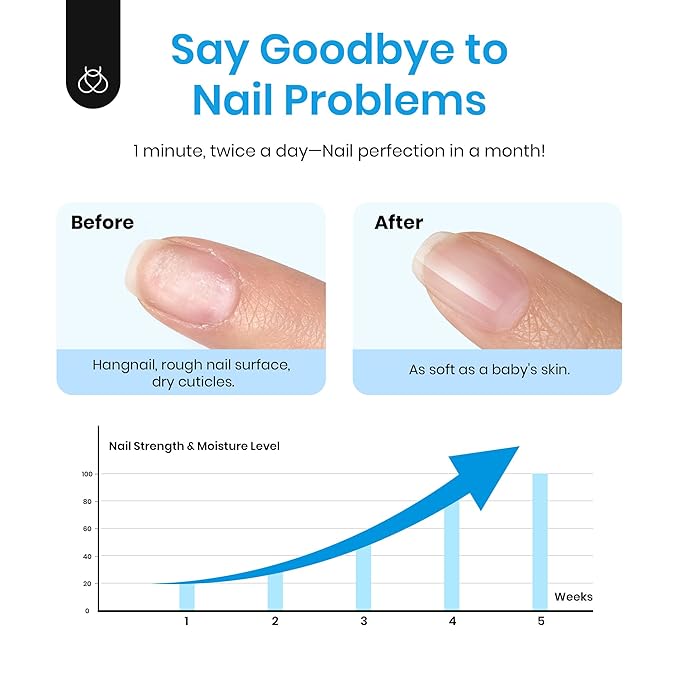Beetles Cuticle Serum for Nail 20ml Nail Care Cuticle Repair Oil with Jojoba Oil & Vitamin E Nail Growth Remedy for Damaged Skin & Thin Nails Spa and Hand Manicure Essentials Gift For Women Girls
