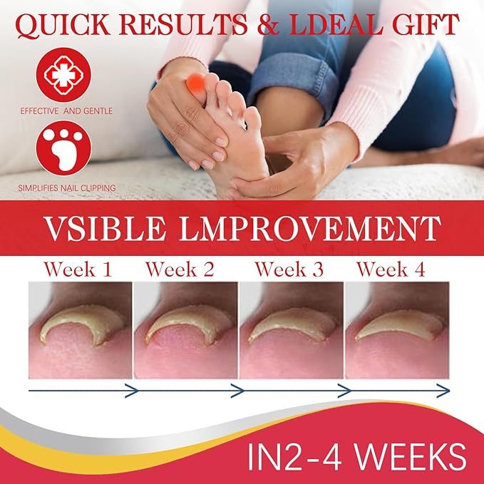 2PCS Ingrown toenail drops,Ingrown Toenail Relief,Easy Trim Ingrown Toenail Tools,Toenail Fluid With Silicone Gel Toe Caps Essential Oil Diffuser,Ingrown Toenail Reliever and Softener Kit