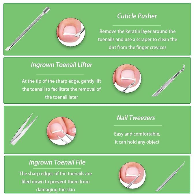 Ingrown Toenail Corrector Set,Professional Foot Care Kit for Treatment & Removal,Includes Ingrown Toenail Corrector,Strips,Tools