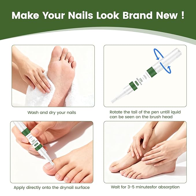 Toenail Fungus Pen, powerful Toenail fungus treatment, repairs damaged nails: yellow nails, discolored nails, thickened nails. Suitable for fingernail fungus treatment. Contains 3 nail fungus pens.