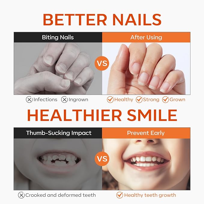 modelones Nail Biting Treatment for Kids Quick Dry Nail Biting Prevention Pen Thumb Sucking Deterrent Bitter No Bite Nail Polish for Nail Care Stop Biting Nails Repair for Damaged Nails 0.48 fl oz