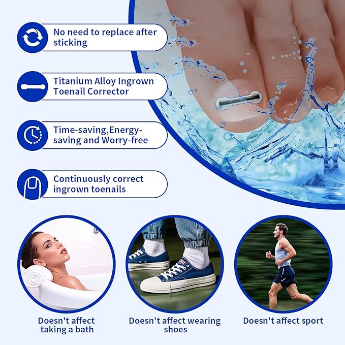 Titanium Alloy Ingrown Toenail Treatment & Corrector Kit - 3 Sizes Corrector for Men & Women Various Nail Sizes & Foot Types,Ingrown Toenail Removal Tool (10 Count-Large Size)