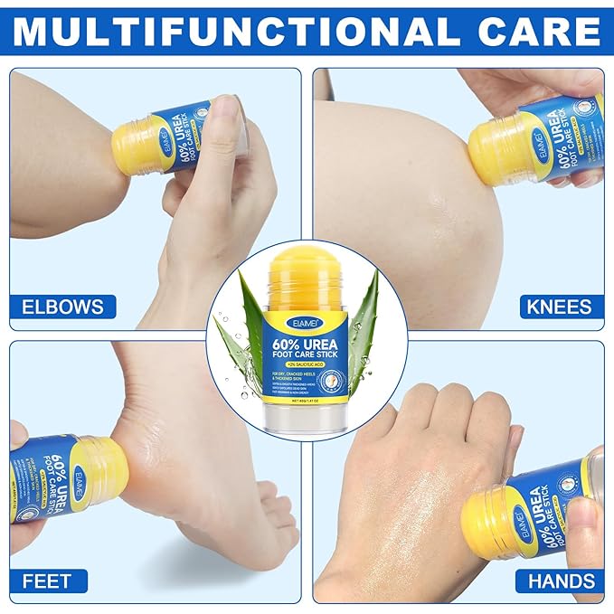 2 Pcs 60% Urea with 2% Salicylic Acid Foot Care Stick, Urea Foot Cream for Cracked Feet, Repairs Dry Rough Heels Fast, Foot Lotion Moisturizer for Dead Skin, Hydrating Heel Balm