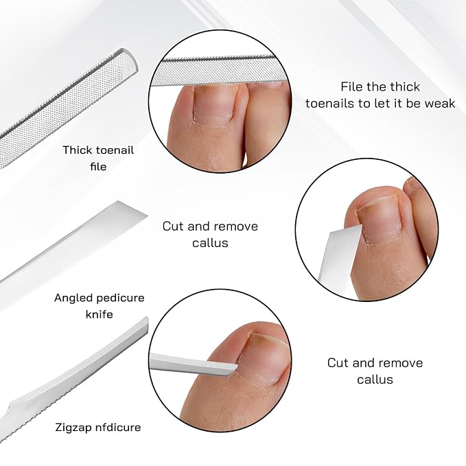 7 Pack Ingrown Toenail Tool Pedicure Tools for Feet, Stainless Steel Toenail Removal Kit, Professional Surgical Manicure Treatment Pedicure Tools for Feet Under Nail Cleaner Correction Polish Pain