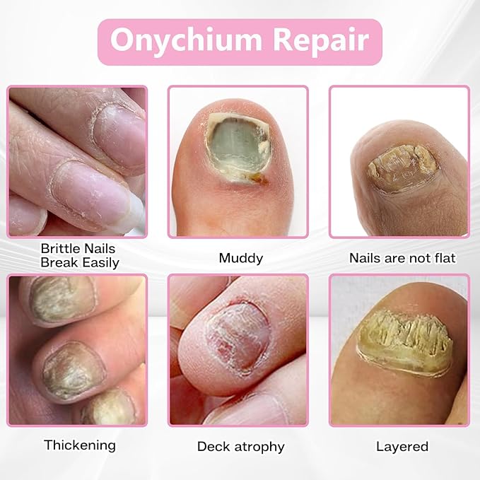Nail Patches - Toenail Care for Toenail Fingernails - 8-Hour Nightime Nail Renewal - 60 PCS