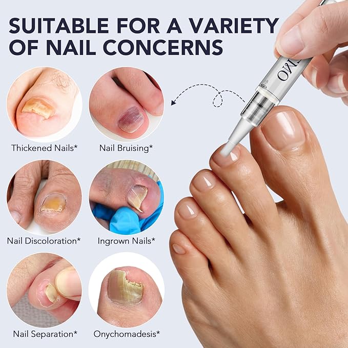Toenail Fungus Pen - Toenail Fungus Treatment Extra Strength for Damaged, Discolored Nail - 25% Undecylenic Acid with Tea Tree, Jojoba, Clove Bud Oils & Aloe - Fungal Nail Repair Pen 5 Pack