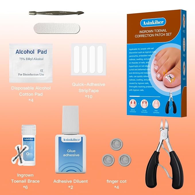 Ingrown Toenail Treatment Kit – Upgraded X-Type Titanium Alloy Corrector for Big Toe Relief, At Home Ingrown Toenail Removal Tool with Clippers and Braces