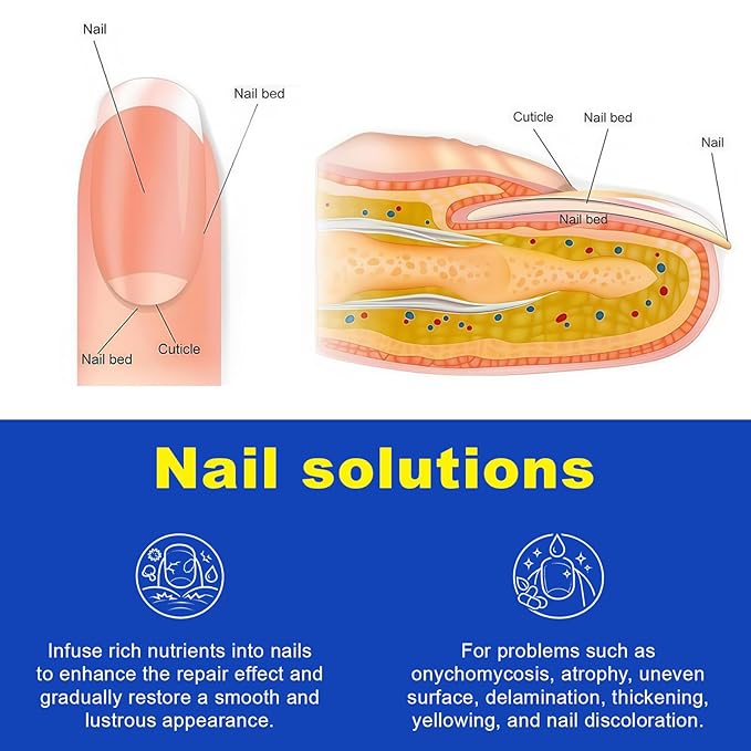 Toenail Fungus Treatment Patches - 21 Pcs Fungal Nail Patches, Extra Strength 8-Hour Formula, for Discolored & Damaged Toenail Care, Overnight Renewal for Men & Women (1 Pack)