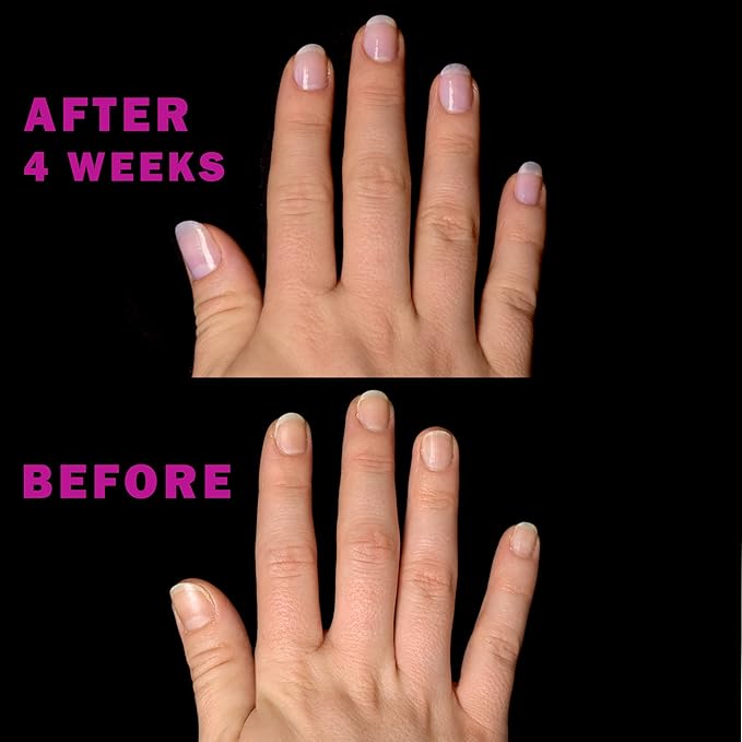 Perfect Formula Pink Gel Coat – Rosey Glow Nail Strengthener & Keratin Treatment, 0.6 oz - Protein-Rich, Glossy Pink Gel Nail Polish for Damaged Nails | Supports Growth & Repair
