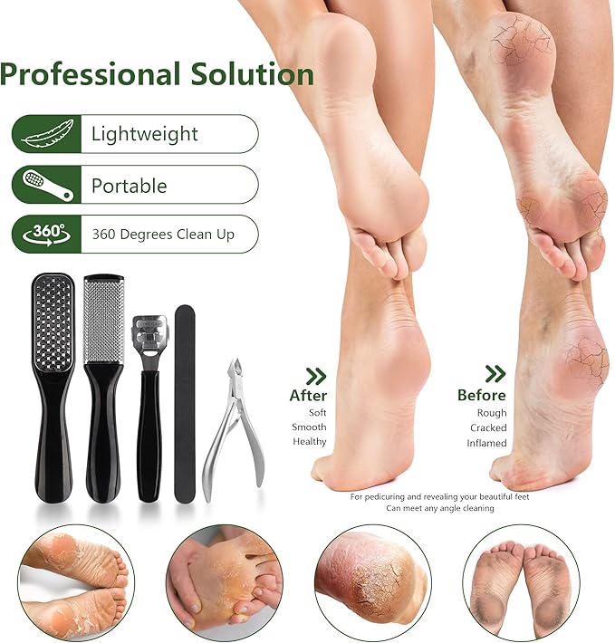 Professional Manicure and Pedicure Tool Kit Professional Exfoliation Foot File Set for Women and Men at Home Or Travel Or Salon to Foot Care (BlackB-30PCS)