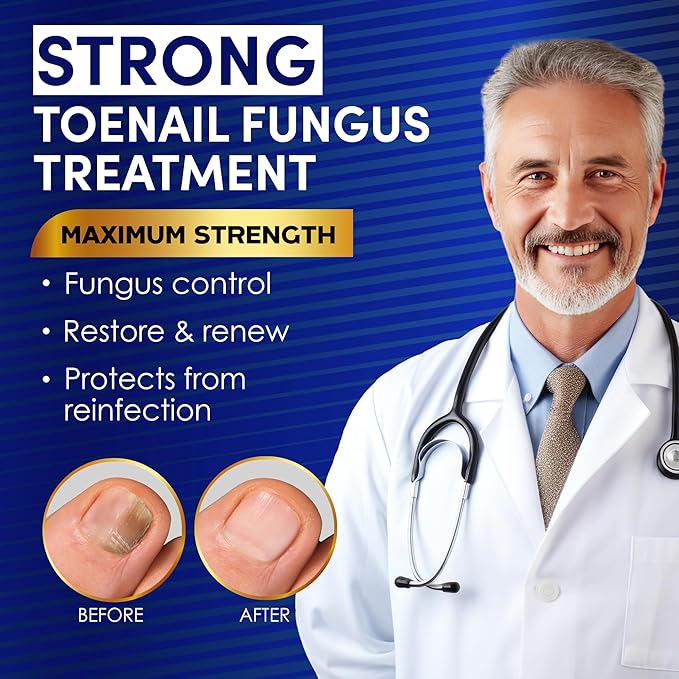 Toenail Fungus Treatment Extra Strength – VTROUY 2 Bottle Nail & Toe Solution with Undecylenic Acid 25% and Tea Tree Oil 15ml 2Pcs