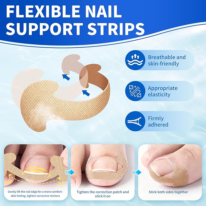 Ingrown Toenail Care Kit with Flexible Strips(134PCS), Professional Toenail Tool Kit Includes Breathable Toenail Bands, Curved Pads, Painless File & Lifter Tools | Home Pedicure Maintenance Set