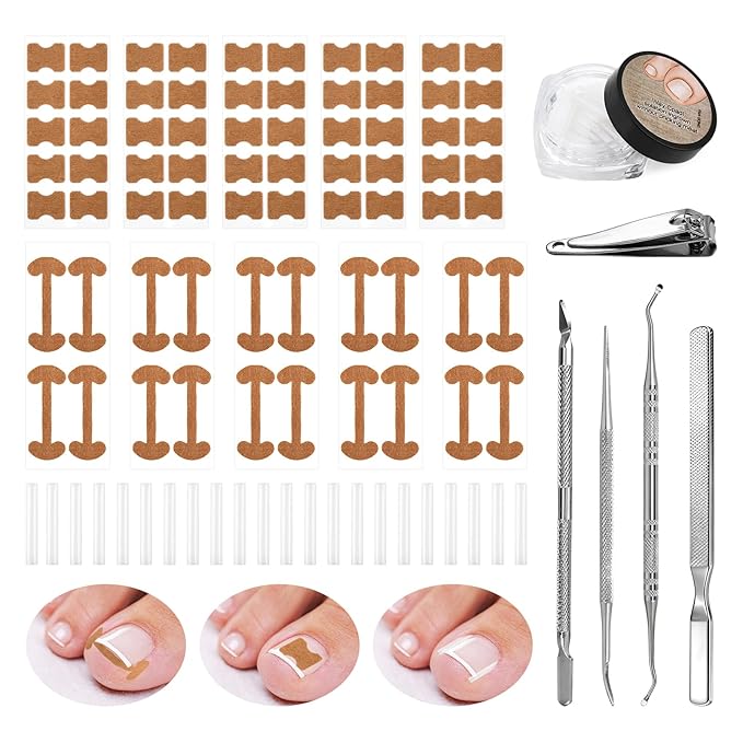 Professional Ingrown Toenail Corrector Set with Correction Strips – Complete Home Pedicure Kit for Men & Women, Non-Slip, Breathable, Pain-Free Relief