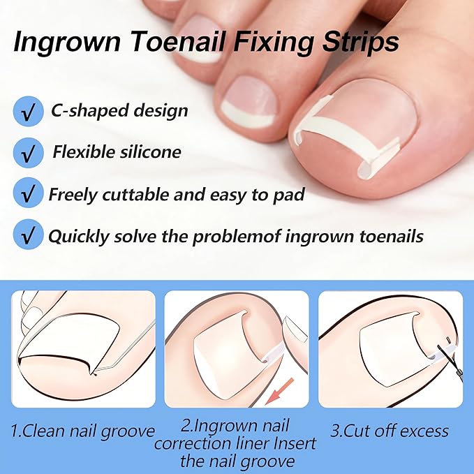 Ingrown Toenail Corrector Set with Correction Strips, Professional Ingrown Toenail Removal Kit, Painless File and Lifter Pedicure Tool Curved Toenails Corrector Patch for men and women